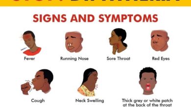Lagos activates emergency response over Diphtheria outbreak