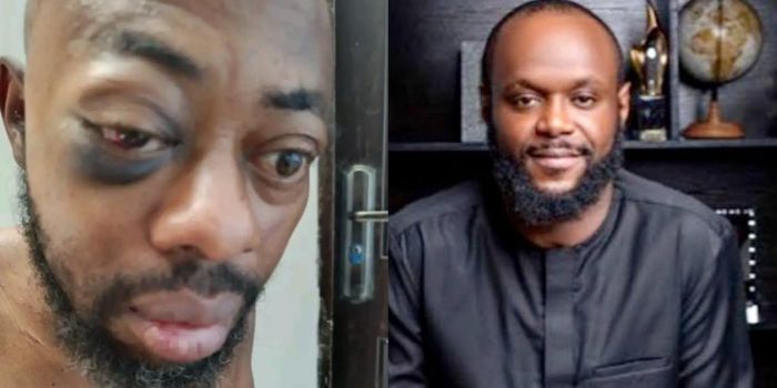 NANS Inauguration Attack: “Seyi Tinubu didn’t do it” - City Boy Movement