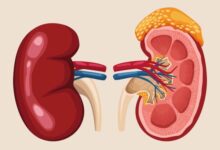 Kidney Economy: Nigeria’s race to outrun organ traffickers